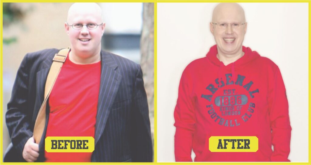 matt lucas weight loss